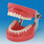 Modelo de Maxilar de Encía Dura (32 dientes)[PRO2001-UL-HD-FEM-32]