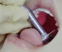 ¡Reflejo de vómito!