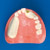 Práctica Comprensiva de Implante (mandíbula maxilar superior) [IMP1011-U-SP], (mandíbula inferior) [IMP1012-L-SP]