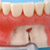 Modelo de Maxilar de Cirugía Oral [SUG1003-UL-SP-FEM-28]