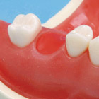 Clavija Déficit (32 dientes) [A2A-240]