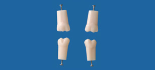 Modelo de Diente de Raíz Sencillo (Dientes Permanentes) [A5A-200]