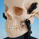 Posición Protrusiva