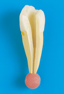 Tratamiento de Conducto