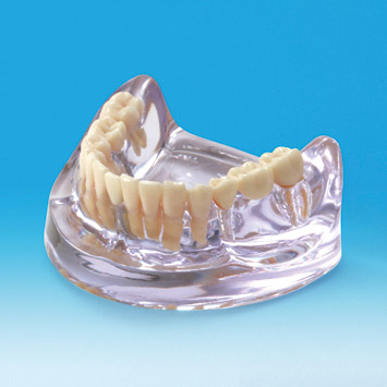 MODELO DE IMPLANTE [PE-IMP003]