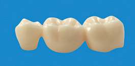 Puente de 3 unidades