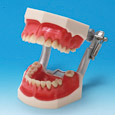 MODELO DE ENFERMEDAD PERIODONTAL [PE-PER003]