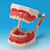 MODELO DE ENFERMEDAD PERIODONTAL [PE-PER003]