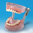 MODELO DE ENFERMEDAD PERIODONTAL [PE-PER004]