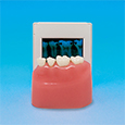 MODELO DE DETECCIÓN DE CARIES INTERPROXIMAL CON RAYOS X [PE-STP009]