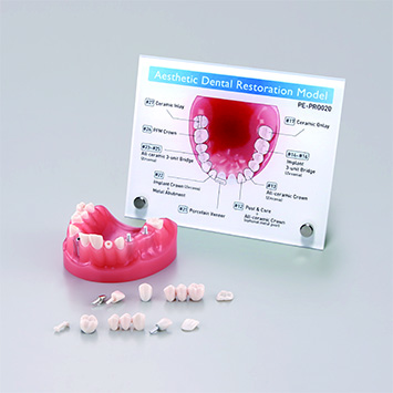 RESTAURACIÓN DENTAL / MODELO DE ESTUDIO DE PRÓTESIS [PE-PRO002]