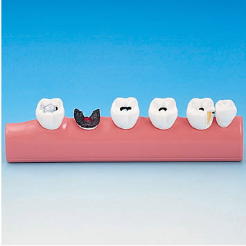 MODELO DE ENFERMEDAD TRANSPARENTE [PE-TDS005]	