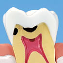 C2(a dentina)