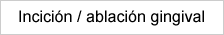 Incición/ablación gingival