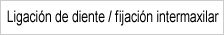 Ligación de diente / fijación intermaxilar 