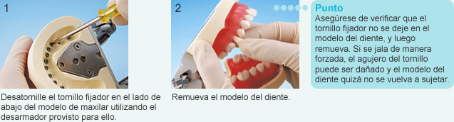 Removiendo el modelo del diente