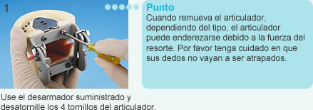 Como remover el articulador