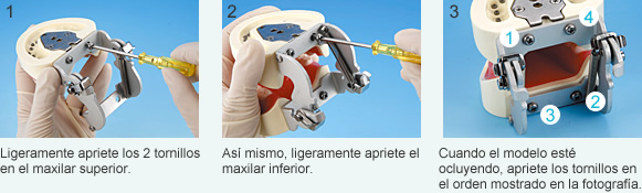 Como sujetar el articulador