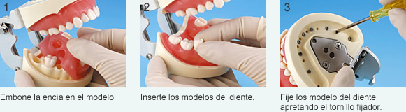 Como sujetar la encía