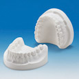 Plaster Jaw Model [PRO2001-UL-PL-32]