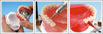 Artificial Teeth Arrangement