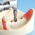 Implant Practice Jaw Model [IMP1001-UL-SP-FEM]