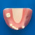 Bone Graft Practice Model [IMP1009-L-SP]