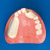 Implant Comprehensive Practice (Maxillary Jaw) [IMP1011-U-SP], (Mandibular Jaw) [IMP1012-L-SP]