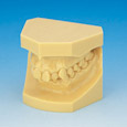 Resin Malocclusion Model [ORT Various Resin]