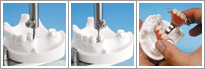 Partial Denture Inspection • Fabrication