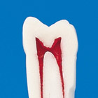 Endodontic Tooth Model [A12A-200]