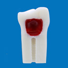 Pedo Endodontic Tooth Model [A12A Series]