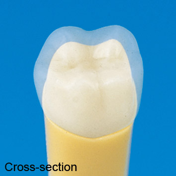 2-Layered Tooth Model [A20A-200]