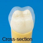 2-Layered Tooth Model [A20A-200]