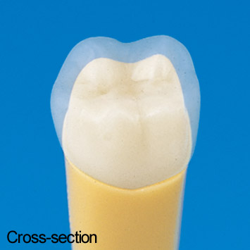 2-Layered Tooth Model  [A20A-500]