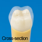 2-Layered Tooth Model [A20A-500]