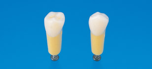 2-Layered Tooth Model [A20A-500]