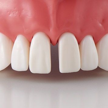 A21A-UR19AE, A21A-UL19AF