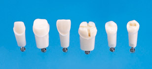 Abutment, Cavity Preparation Tooth Model [A21A_A25A Series]
