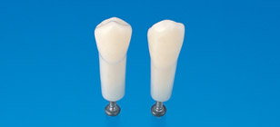 Simple Root Tooth Model (Permanent Tooth) [A5A-500]
