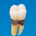 Simple Root Tooth Model (Permanent Tooth) [B1A-901C]