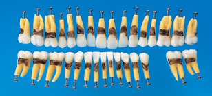Anatomical Simple Root Tooth Model [B1A-901C]