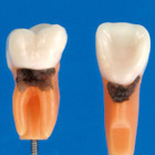 Simple Root Tooth Model (Permanent Tooth) [AA5A-200]