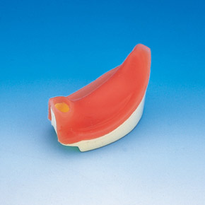 Implant Socket[IMP1002-T-SP]