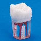 Endodontic Tooth Model [S12A-200]