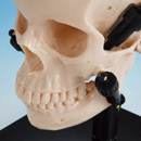 Table of Wax Rim Types