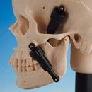 Table of Wax Rim Types