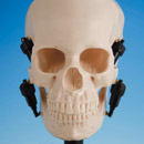 Intercuspal Position