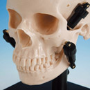 Intercuspal Position