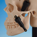 Intercuspal Position